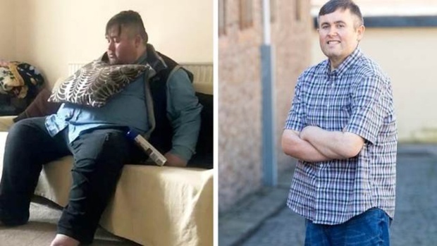 Испугавшись смерти, мужчина похудел на 108 килограммов всего за год