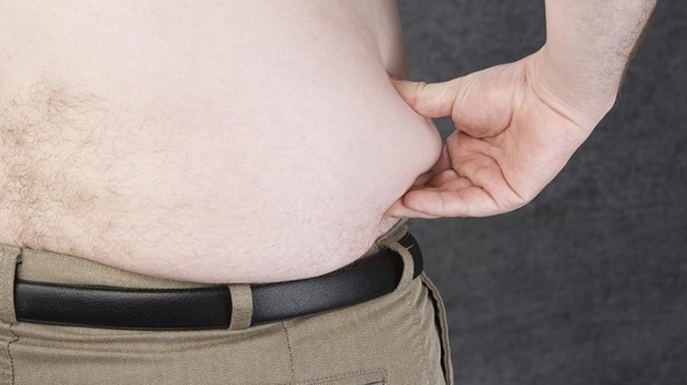 Каждый третий мужчина в России страдает от ожирения